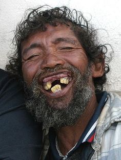 dents.jpg